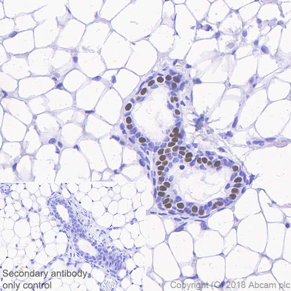 Immunohistochemistry (Formalin/PFA-fixed paraffin-embedded sections) - Anti-Progesterone Receptor antibody [SP42] (AB101688), expandable thumbnail