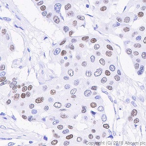 Immunohistochemistry (Formalin/PFA-fixed paraffin-embedded sections) - Anti-Progesterone Receptor antibody [SP42] (ab101688), expandable thumbnail