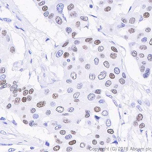 Immunohistochemistry (Formalin/PFA-fixed paraffin-embedded sections) - Anti-Progesterone Receptor antibody [SP42] (AB101688)