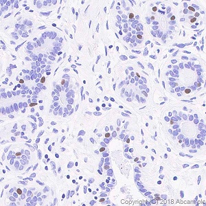 Immunohistochemistry (Formalin/PFA-fixed paraffin-embedded sections) - Anti-Progesterone Receptor antibody [SP42] (ab101688), expandable thumbnail