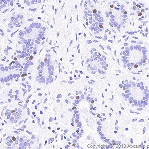 Anti-Progesterone Receptor antibody [SP42] (ab101688) | Abcam