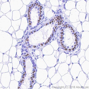 Immunohistochemistry (Formalin/PFA-fixed paraffin-embedded sections) - Anti-Progesterone Receptor antibody [SP42] (ab101688), expandable thumbnail