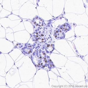 Immunohistochemistry (Formalin/PFA-fixed paraffin-embedded sections) - Anti-Progesterone Receptor antibody [SP42] (ab101688), expandable thumbnail