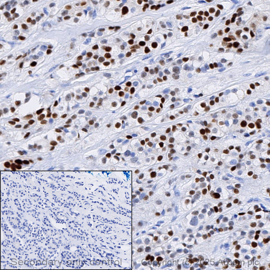 Immunohistochemistry (Formalin/PFA-fixed paraffin-embedded sections) - Anti-Progesterone Receptor antibody [SP42] (AB101688)