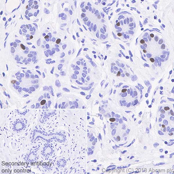 Immunohistochemistry (Formalin/PFA-fixed paraffin-embedded sections) - Anti-Progesterone Receptor antibody [SP42] (ab101688), expandable thumbnail