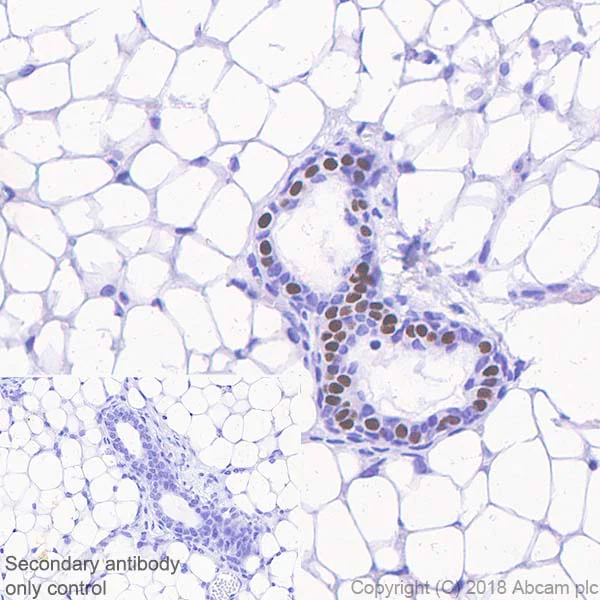 Immunohistochemistry (Formalin/PFA-fixed paraffin-embedded sections) - Anti-Progesterone Receptor antibody [SP42] - BSA and Azide free (AB236222)