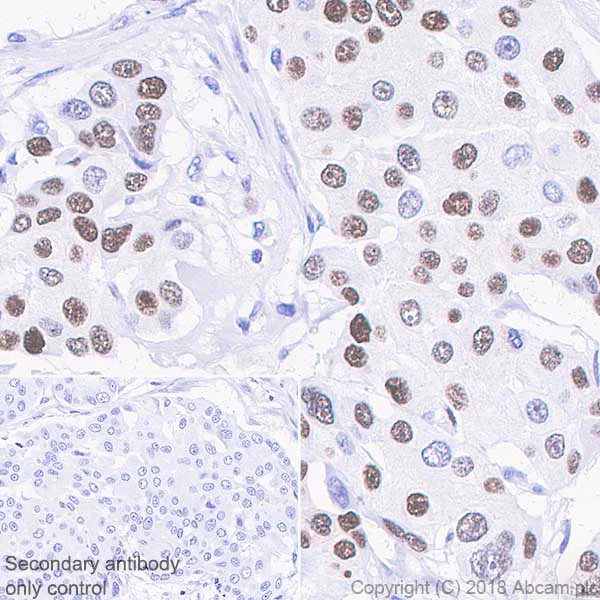 Immunohistochemistry (Formalin/PFA-fixed paraffin-embedded sections) - Anti-Progesterone Receptor antibody [SP42] - BSA and Azide free (AB236222)