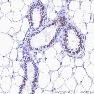 Immunohistochemistry (Formalin/PFA-fixed paraffin-embedded sections) - Anti-Progesterone Receptor antibody [SP42] - BSA and Azide free (AB236222)