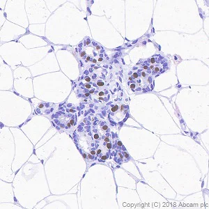 Immunohistochemistry (Formalin/PFA-fixed paraffin-embedded sections) - Anti-Progesterone Receptor antibody [SP42] - BSA and Azide free (AB236222)