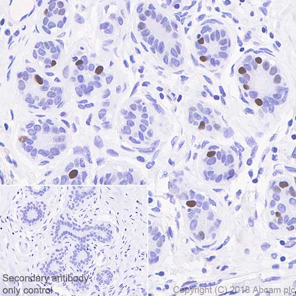 Immunohistochemistry (Formalin/PFA-fixed paraffin-embedded sections) - Anti-Progesterone Receptor antibody [SP42] - BSA and Azide free (AB236222)
