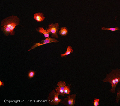 Immunocytochemistry/ Immunofluorescence - Anti-Progesterone Receptor antibody [YR85] (AB32085), expandable thumbnail