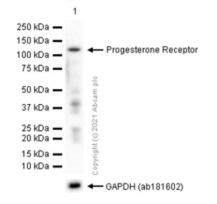 Western blot - Anti-Progesterone Receptor antibody [YR85] (AB32085), expandable thumbnail