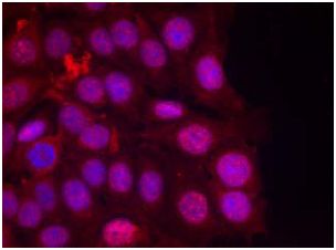 Immunocytochemistry/ Immunofluorescence - Anti-Progesterone Receptor (phospho S190) antibody (AB131110), expandable thumbnail