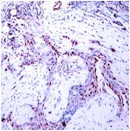 Immunohistochemistry (Formalin/PFA-fixed paraffin-embedded sections) - Anti-Progesterone Receptor (phospho S190) antibody (AB131110)