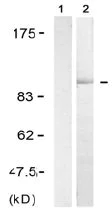 Western blot - Anti-Progesterone Receptor (phospho S190) antibody (AB131110)