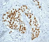 Immunohistochemistry (Formalin/PFA-fixed paraffin-embedded sections) - Anti-Progesterone Receptor (phospho S190) antibody [EP1516Y] - BSA and Azide free (AB247409)