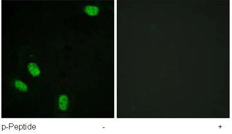Immunocytochemistry/ Immunofluorescence - Anti-Progesterone Receptor (phospho S294) antibody (AB61785)