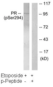 Western blot - Anti-Progesterone Receptor (phospho S294) antibody (AB61785)