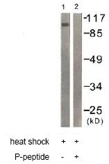 Western blot - Anti-Progesterone Receptor (phospho S400) antibody (AB60954)