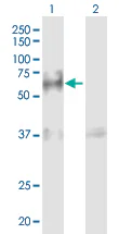 Western blot - Anti-Progranulin antibody (AB169325)