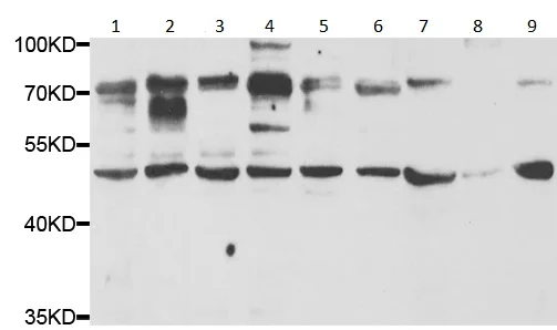 Western blot - Anti-Progranulin antibody (AB191211)