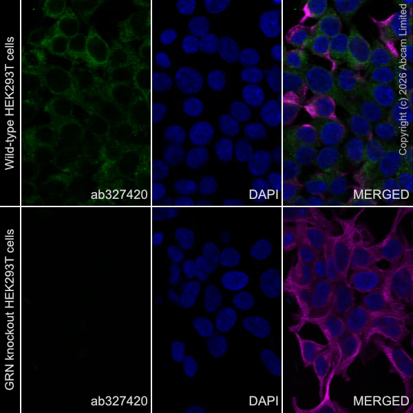 Immunocytochemistry/ Immunofluorescence - Anti-Progranulin antibody [MJF-D22103-42R] - BSA and Azide free (AB327428)