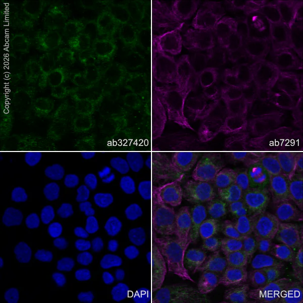 Immunocytochemistry/ Immunofluorescence - Anti-Progranulin antibody [MJF-D22103-42R] - BSA and Azide free (AB327428)