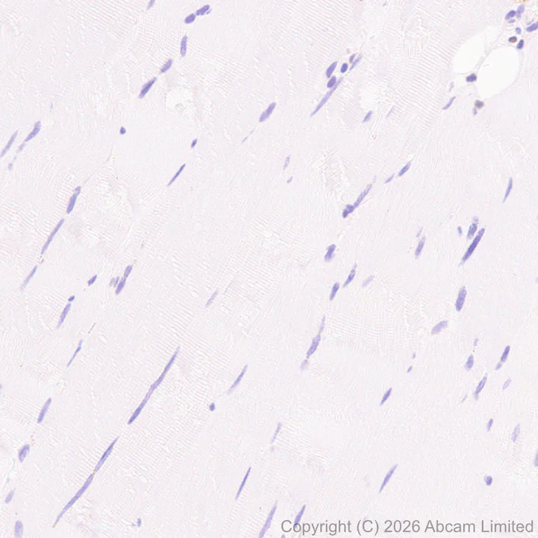 Immunohistochemistry (Formalin/PFA-fixed paraffin-embedded sections) - Anti-Progranulin antibody [MJF-D22103-42R] - BSA and Azide free (AB327428)