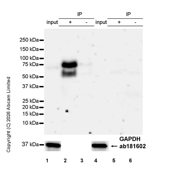 Immunoprecipitation - Anti-Progranulin antibody [MJF-D22103-42R] - BSA and Azide free (AB327428)