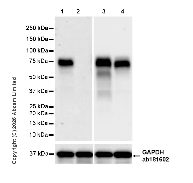 Western blot - Anti-Progranulin antibody [MJF-D22103-42R] - BSA and Azide free (AB327428)