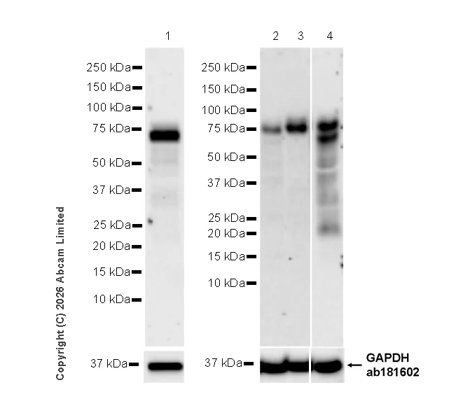 Western blot - Anti-Progranulin antibody [MJF-D22103-42R] - BSA and Azide free (AB327428)