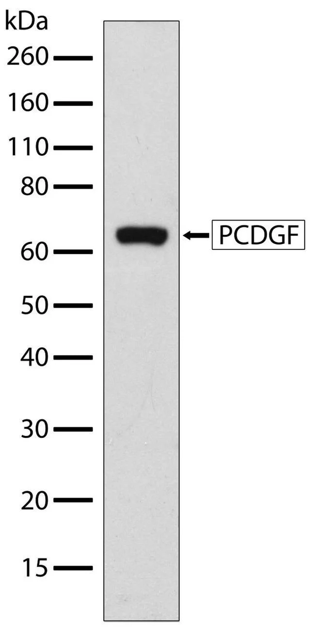 Western blot - Anti-Progranulin antibody [RP23040042] (AB308026)