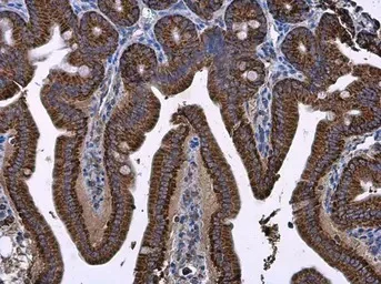 Immunohistochemistry (Formalin/PFA-fixed paraffin-embedded sections) - Anti-Prohibitin antibody (AB154589)