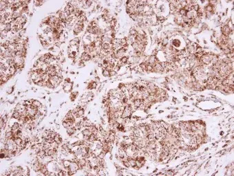 Immunohistochemistry (Formalin/PFA-fixed paraffin-embedded sections) - Anti-Prohibitin antibody (AB154589)