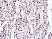 Immunohistochemistry (Formalin/PFA-fixed paraffin-embedded sections) - Anti-Prohibitin antibody (AB154589)