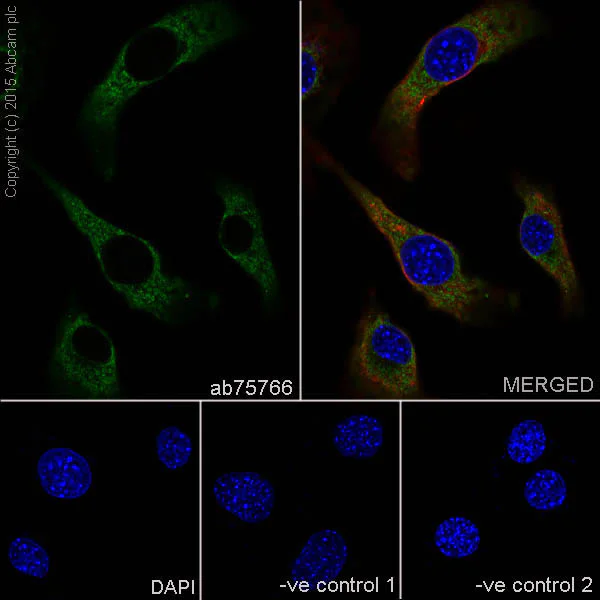 Immunocytochemistry/ Immunofluorescence - Anti-Prohibitin antibody [EP2803Y] (AB75766)