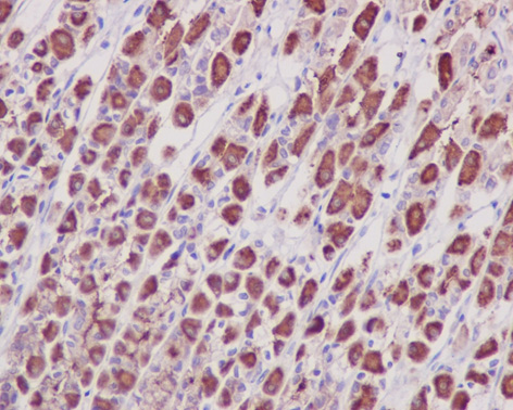 Immunohistochemistry (Formalin/PFA-fixed paraffin-embedded sections) - Anti-Prohibitin antibody [EP2803Y] (ab75766), expandable thumbnail