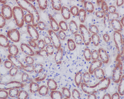 Immunohistochemistry (Formalin/PFA-fixed paraffin-embedded sections) - Anti-Prohibitin antibody [EP2803Y] (ab75766), expandable thumbnail