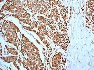 Immunohistochemistry (Formalin/PFA-fixed paraffin-embedded sections) - Anti-Prohibitin antibody [EP2803Y] (ab75766), expandable thumbnail