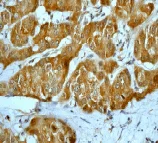 Immunohistochemistry (Formalin/PFA-fixed paraffin-embedded sections) - Anti-Prohibitin antibody [EP2803Y] (AB75766)