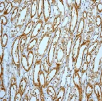 Immunohistochemistry (Formalin/PFA-fixed paraffin-embedded sections) - Anti-Prohibitin antibody [EP2803Y] (AB75766)