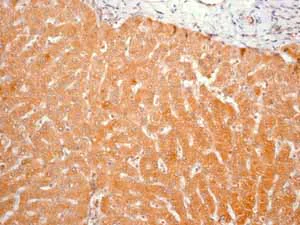 Immunohistochemistry (Formalin/PFA-fixed paraffin-embedded sections) - Anti-Prohibitin antibody [EP2803Y] (AB75766)