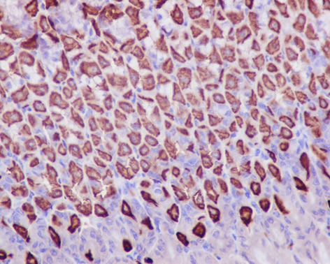 Immunohistochemistry (Formalin/PFA-fixed paraffin-embedded sections) - Anti-Prohibitin antibody [EP2803Y] (ab75766), expandable thumbnail