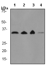 Western blot - Anti-Prohibitin antibody [EP2803Y] (ab75766), expandable thumbnail