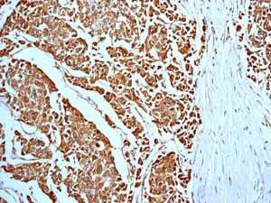 Immunohistochemistry (Formalin/PFA-fixed paraffin-embedded sections) - Anti-Prohibitin antibody [EP2803Y] - BSA and Azide free (AB239865)