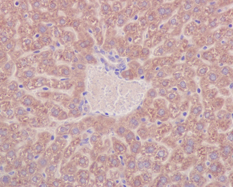 Immunohistochemistry (Formalin/PFA-fixed paraffin-embedded sections) - Anti-Prohibitin antibody [EP2803Y] - BSA and Azide free (ab239865), expandable thumbnail