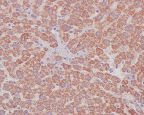 Immunohistochemistry (Formalin/PFA-fixed paraffin-embedded sections) - Anti-Prohibitin antibody [EP2804Y] - Mitochondrial Marker (AB75771)