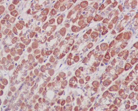 Immunohistochemistry (Formalin/PFA-fixed paraffin-embedded sections) - Anti-Prohibitin antibody [EP2804Y] - Mitochondrial Marker (AB75771)