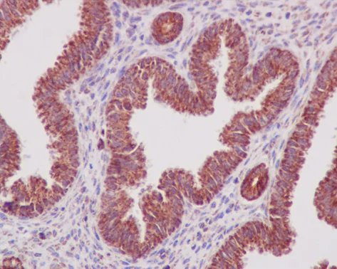 Immunohistochemistry (Formalin/PFA-fixed paraffin-embedded sections) - Anti-Prohibitin antibody [EP2804Y] - Mitochondrial Marker (AB75771)