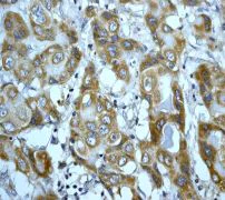 Immunohistochemistry (Formalin/PFA-fixed paraffin-embedded sections) - Anti-Prohibitin antibody [EP2804Y] - Mitochondrial Marker (AB75771)
